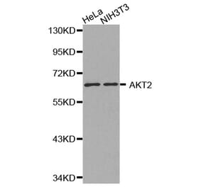 Western blot - AKT2 antibody from Signalway Antibody (38130) - Antibodies.com