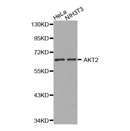 Western blot - AKT2 antibody from Signalway Antibody (38130) - Antibodies.com