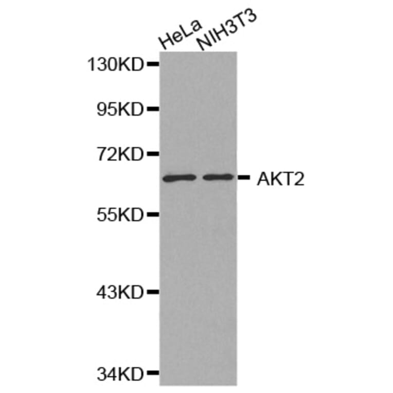 Western blot - AKT2 antibody from Signalway Antibody (38130) - Antibodies.com