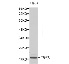 Western blot - TGFA antibody from Signalway Antibody (38131) - Antibodies.com