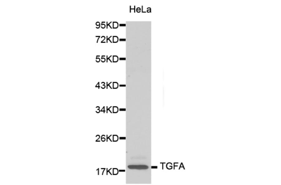 Western blot - TGFA antibody from Signalway Antibody (38131) - Antibodies.com