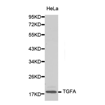Western blot - TGFA antibody from Signalway Antibody (38131) - Antibodies.com