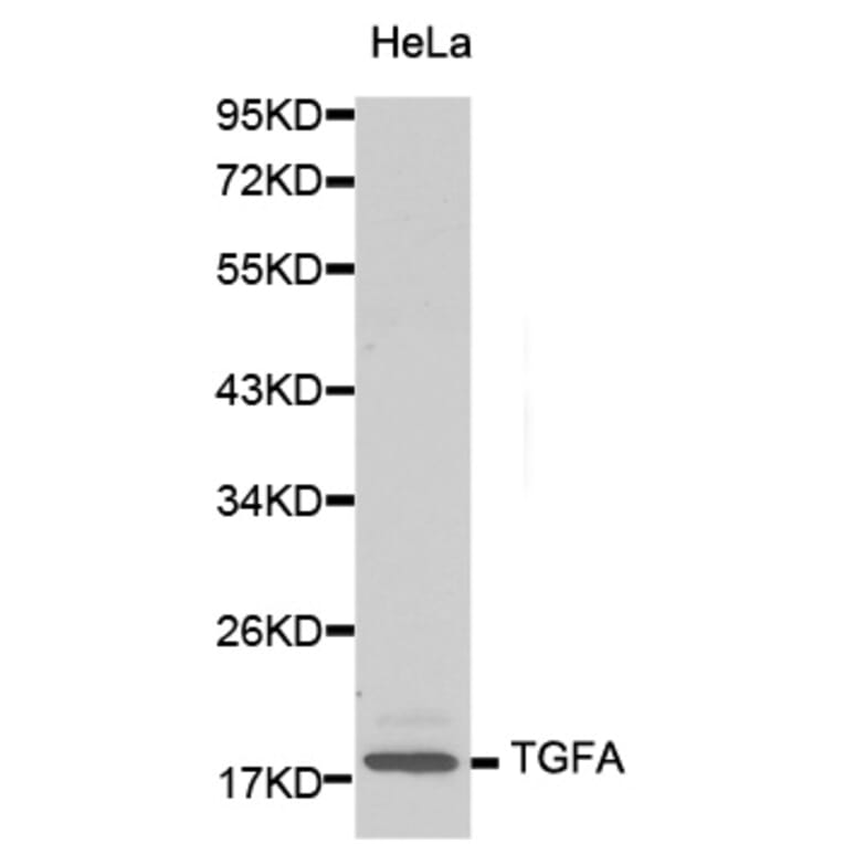 Western blot - TGFA antibody from Signalway Antibody (38131) - Antibodies.com