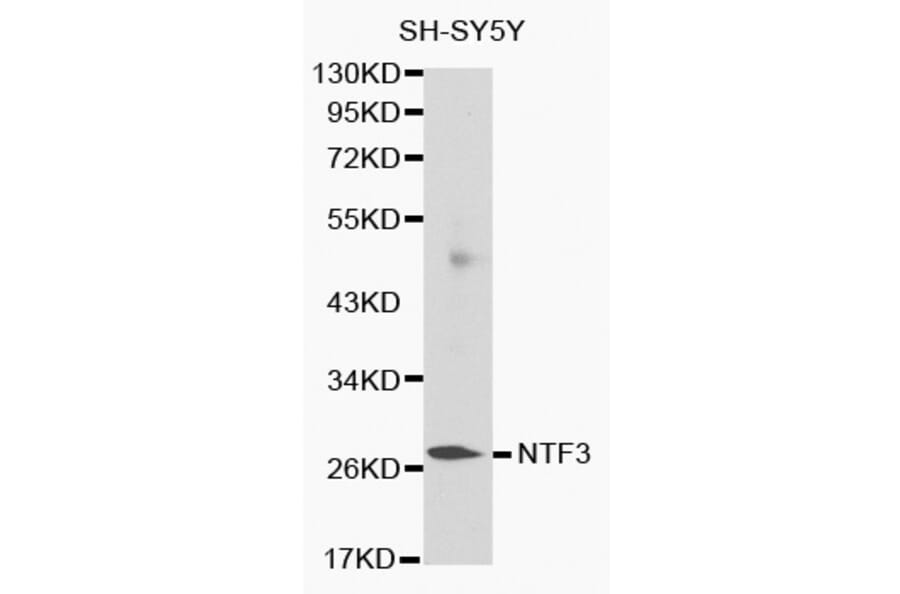Western blot - NTF3 antibody from Signalway Antibody (38132) - Antibodies.com