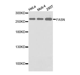 Western blot - FASN antibody from Signalway Antibody (38133) - Antibodies.com