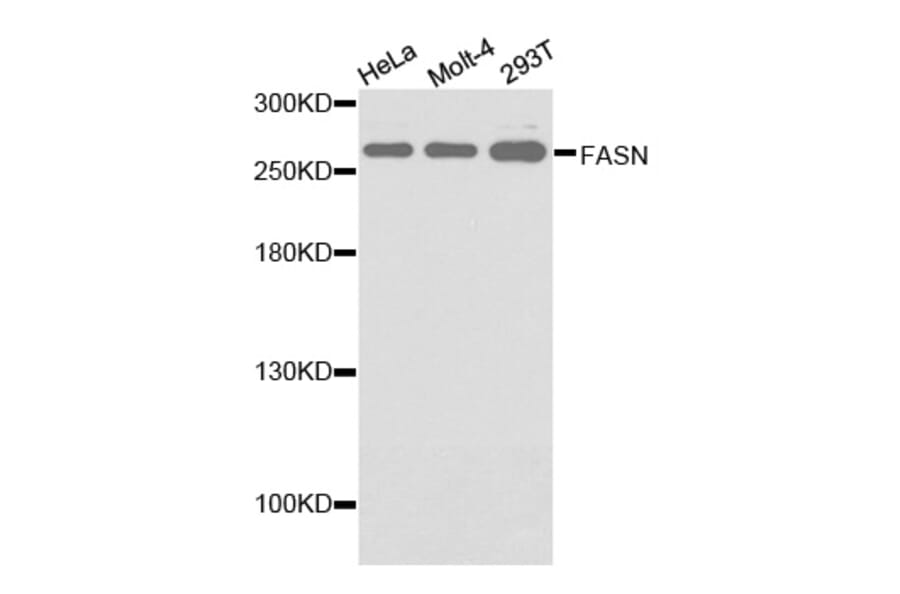 Western blot - FASN antibody from Signalway Antibody (38133) - Antibodies.com