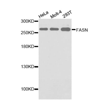 Western blot - FASN antibody from Signalway Antibody (38133) - Antibodies.com