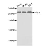 Western blot - FASN antibody from Signalway Antibody (38133) - Antibodies.com