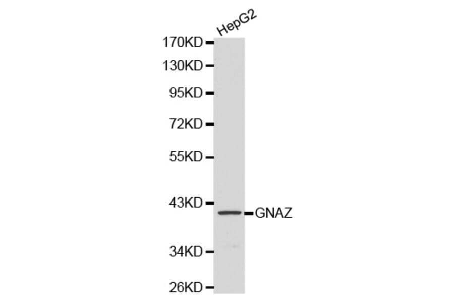 Western blot - GNAZ antibody from Signalway Antibody (38135) - Antibodies.com