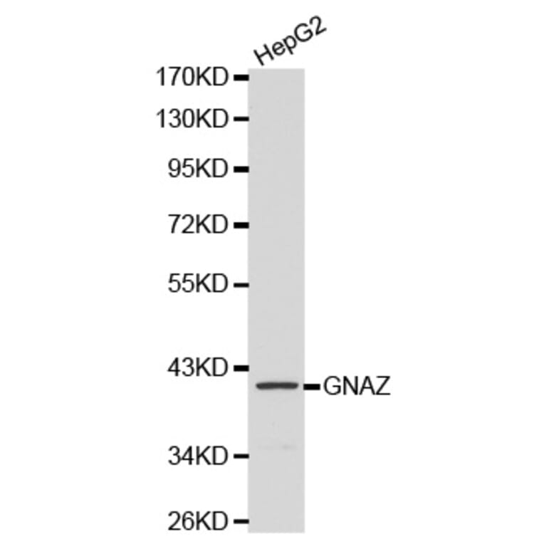Western blot - GNAZ antibody from Signalway Antibody (38135) - Antibodies.com