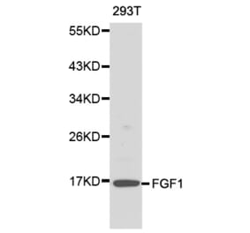 Western blot - FGF1 antibody from Signalway Antibody (38145) - Antibodies.com