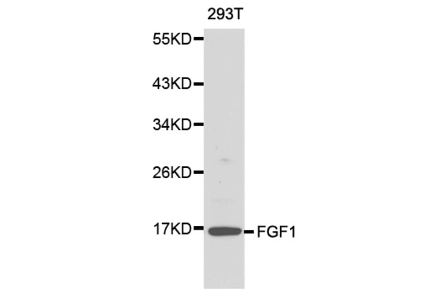Western blot - FGF1 antibody from Signalway Antibody (38145) - Antibodies.com