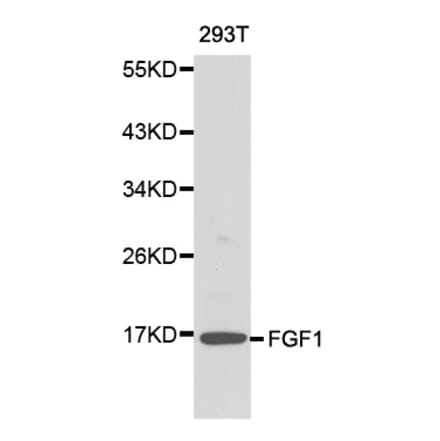Western blot - FGF1 antibody from Signalway Antibody (38145) - Antibodies.com