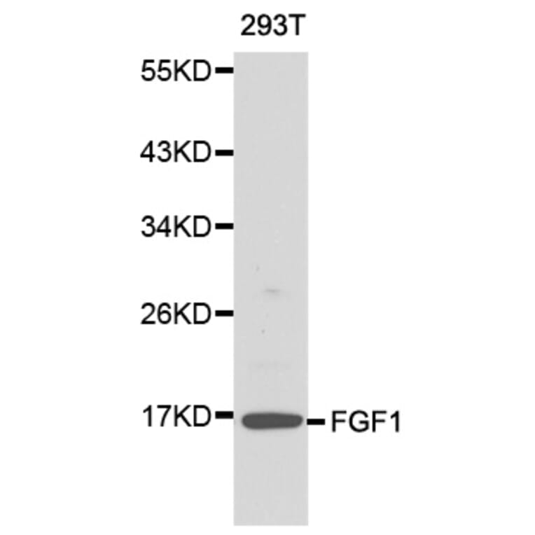 Western blot - FGF1 antibody from Signalway Antibody (38145) - Antibodies.com