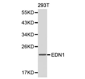 Western blot - EDN1 antibody from Signalway Antibody (38146) - Antibodies.com