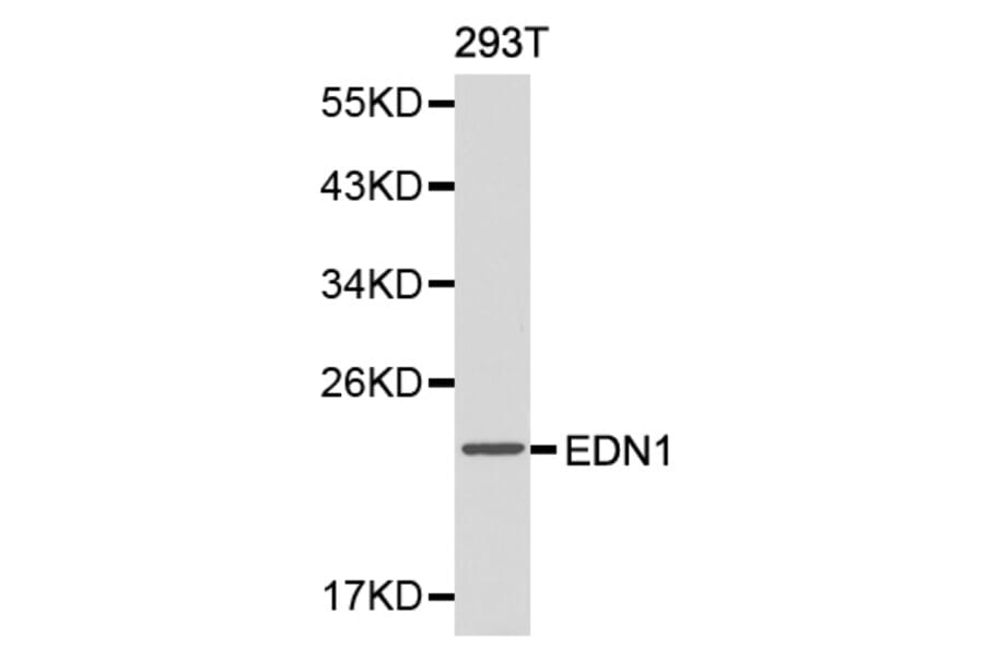 Western blot - EDN1 antibody from Signalway Antibody (38146) - Antibodies.com