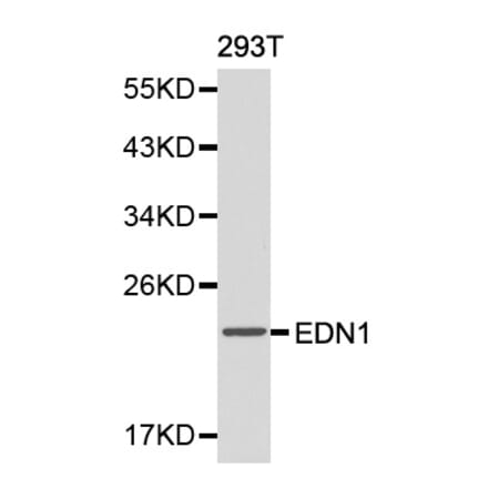 Western blot - EDN1 antibody from Signalway Antibody (38146) - Antibodies.com