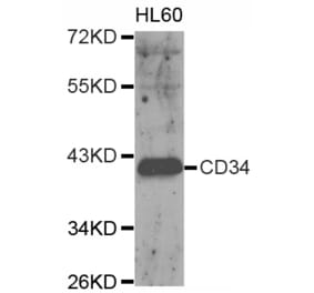 Western blot - CD34 antibody from Signalway Antibody (38153) - Antibodies.com