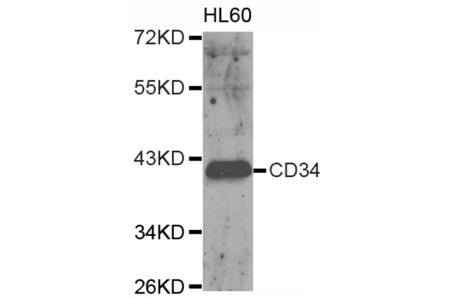 Western blot - CD34 antibody from Signalway Antibody (38153) - Antibodies.com