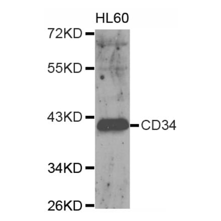 Western blot - CD34 antibody from Signalway Antibody (38153) - Antibodies.com