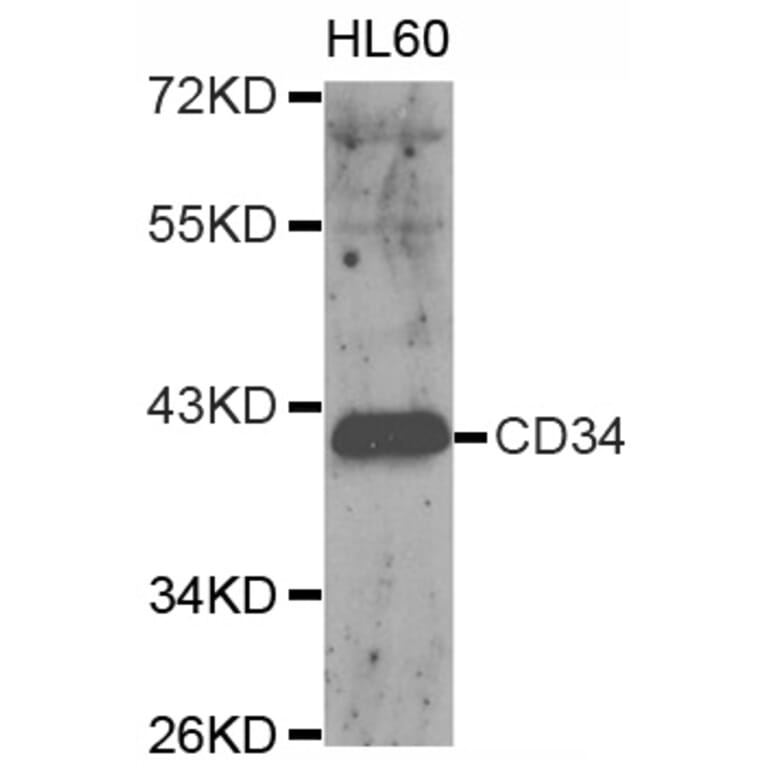 Western blot - CD34 antibody from Signalway Antibody (38153) - Antibodies.com