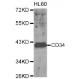Western blot - CD34 antibody from Signalway Antibody (38153) - Antibodies.com