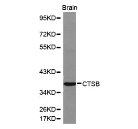 Western blot - CTSB antibody from Signalway Antibody (38155) - Antibodies.com