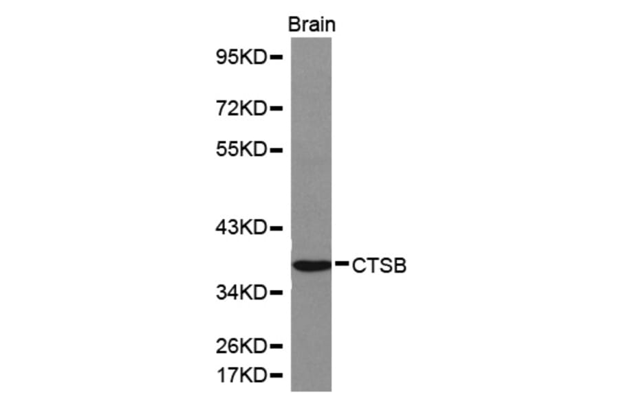 Western blot - CTSB antibody from Signalway Antibody (38155) - Antibodies.com