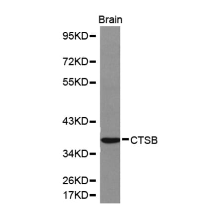 Western blot - CTSB antibody from Signalway Antibody (38155) - Antibodies.com