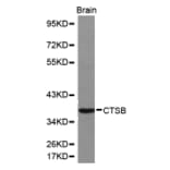 Western blot - CTSB antibody from Signalway Antibody (38155) - Antibodies.com