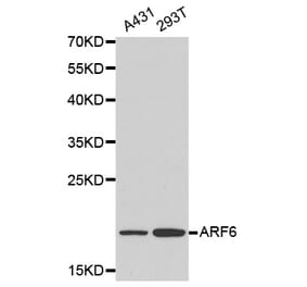 Western blot - ARF6 antibody from Signalway Antibody (38160) - Antibodies.com