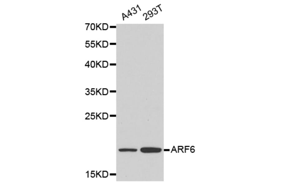 Western blot - ARF6 antibody from Signalway Antibody (38160) - Antibodies.com