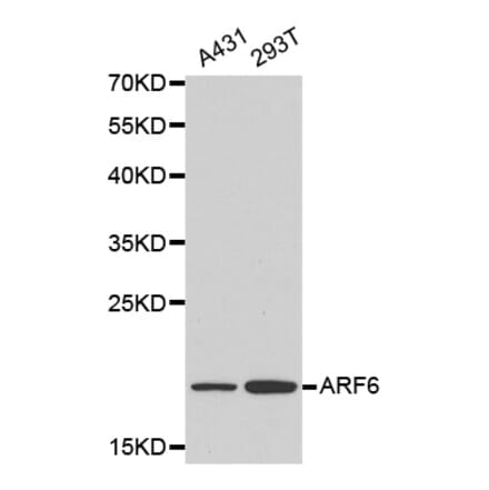 Western blot - ARF6 antibody from Signalway Antibody (38160) - Antibodies.com