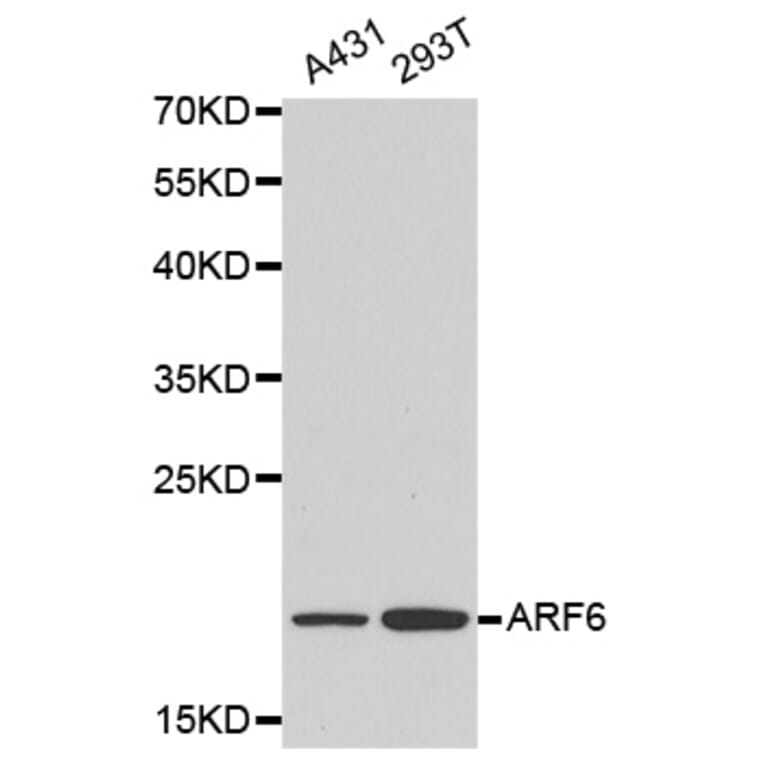 Western blot - ARF6 antibody from Signalway Antibody (38160) - Antibodies.com