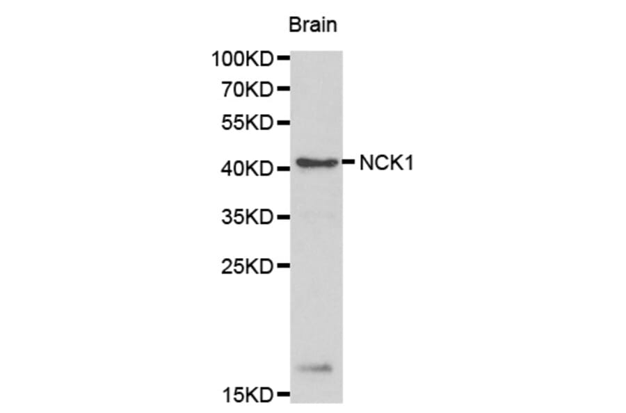 Western blot - NCK1 antibody from Signalway Antibody (38165) - Antibodies.com
