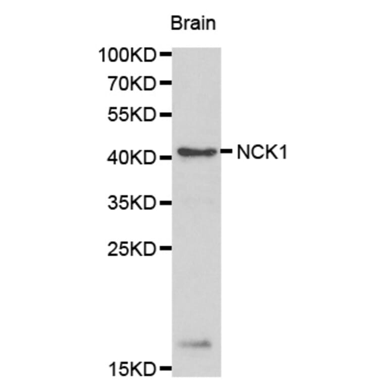Western blot - NCK1 antibody from Signalway Antibody (38165) - Antibodies.com