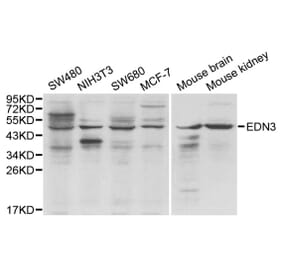 Western blot - EDN3 antibody from Signalway Antibody (38167) - Antibodies.com