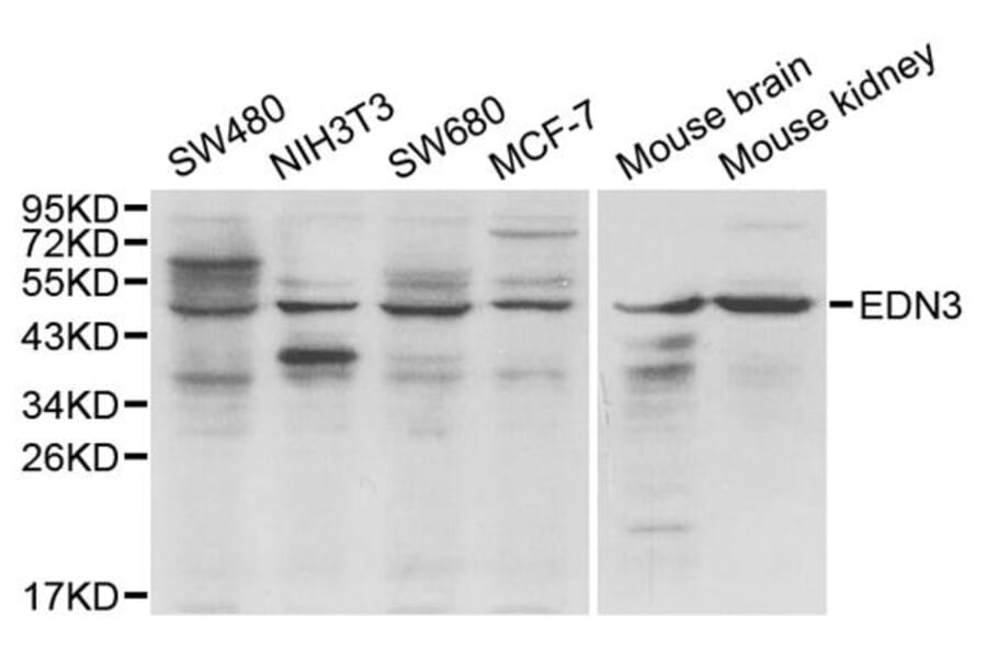 Western blot - EDN3 antibody from Signalway Antibody (38167) - Antibodies.com