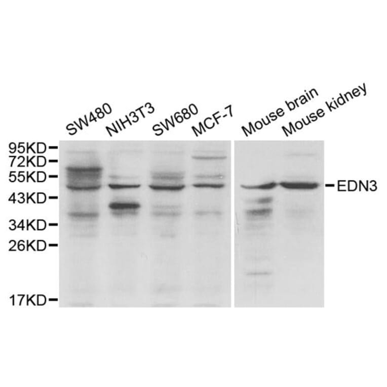 Western blot - EDN3 antibody from Signalway Antibody (38167) - Antibodies.com