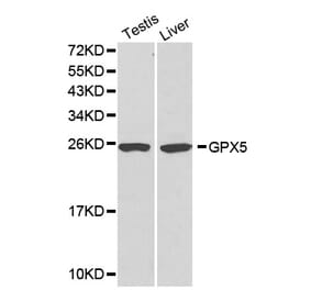 Western blot - GPX5 antibody from Signalway Antibody (38176) - Antibodies.com