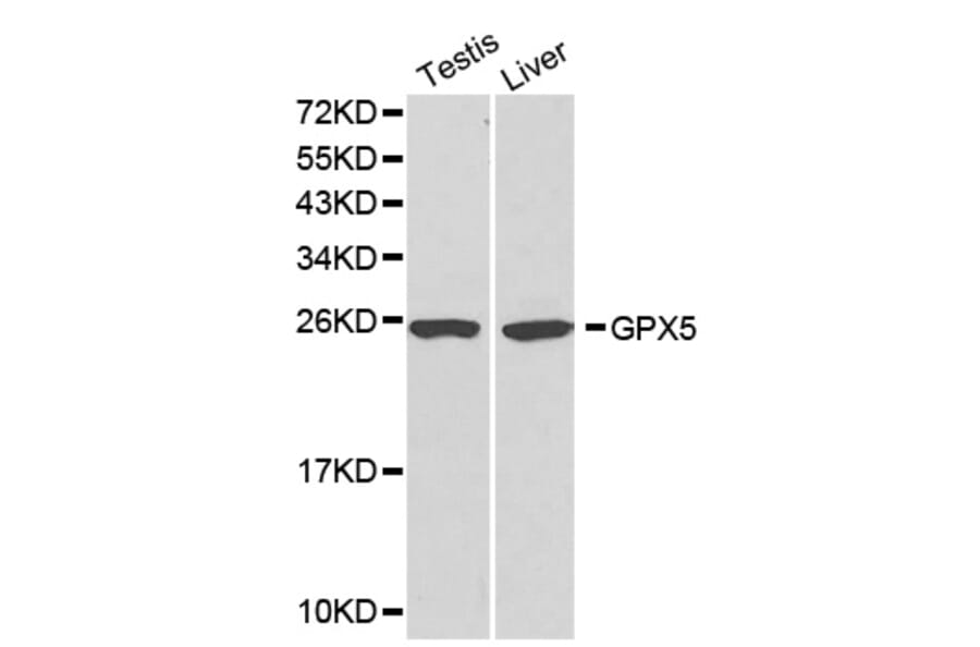 Western blot - GPX5 antibody from Signalway Antibody (38176) - Antibodies.com