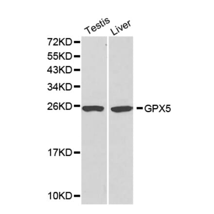 Western blot - GPX5 antibody from Signalway Antibody (38176) - Antibodies.com