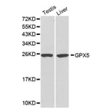 Western blot - GPX5 antibody from Signalway Antibody (38176) - Antibodies.com