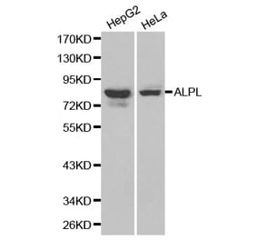 Western blot - ALPL antibody from Signalway Antibody (38179) - Antibodies.com