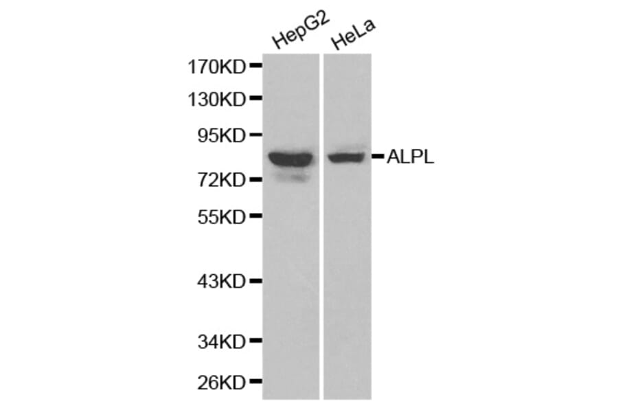 Western blot - ALPL antibody from Signalway Antibody (38179) - Antibodies.com