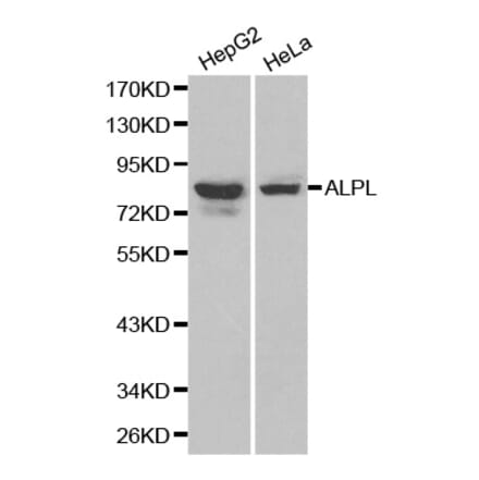 Western blot - ALPL antibody from Signalway Antibody (38179) - Antibodies.com