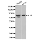 Western blot - ALPL antibody from Signalway Antibody (38179) - Antibodies.com