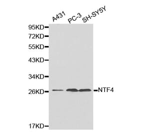 Western blot - NTF4 antibody from Signalway Antibody (38180) - Antibodies.com