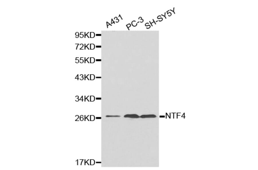 Western blot - NTF4 antibody from Signalway Antibody (38180) - Antibodies.com