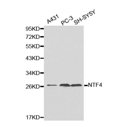 Western blot - NTF4 antibody from Signalway Antibody (38180) - Antibodies.com